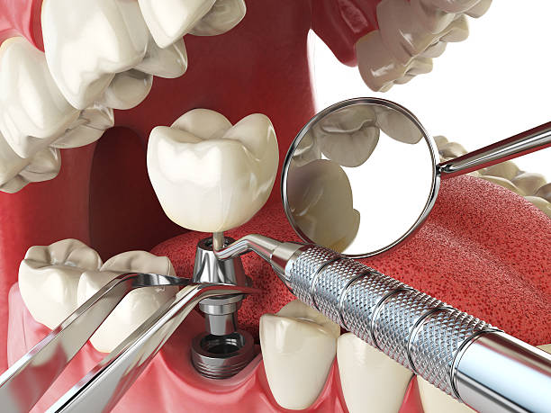 Best Emergency Denture Repair in Raceland, KY